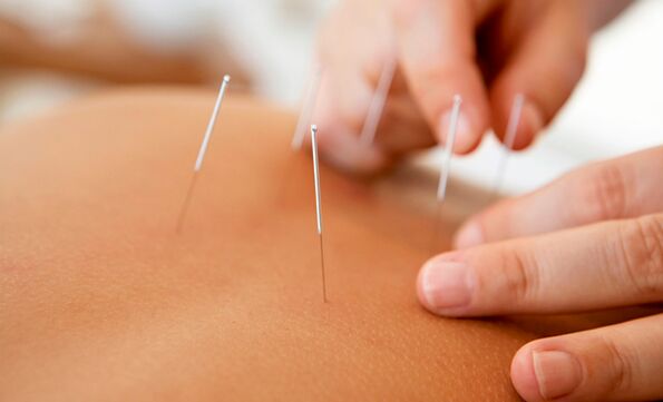 acupuncture to increase potency